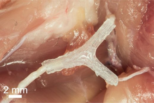 Напечатанный на 3D-принтере проводник для регенерации нерва помог улучшить движения крысы через 10-12 недель после имплантации.