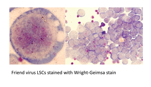 Ученые Penn State первоначально протестировали одно из соединений, полученных из рыбьего жира, на типе лейкемии, индуцируемом у мышей вирусом Friend. На снимке стволовые клетки этой лейкемии.