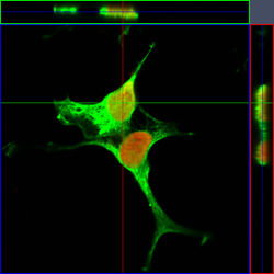 Две клетки с избыточной продукцией белка AIMP2 (зеленый), взаимодействующего с ферментом PARP1 (красный) в ядрах клеток.
