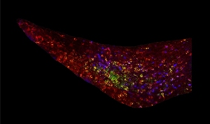 Сегмент мозга мыши светится флуоресцентными маркерами, указывающими на дофаминергические нейроны. Зеленые клетки обеспечивают дофамином субвентрикулярную зону – область, в которой процесс нейрогенеза идет на протяжении всей жизни.