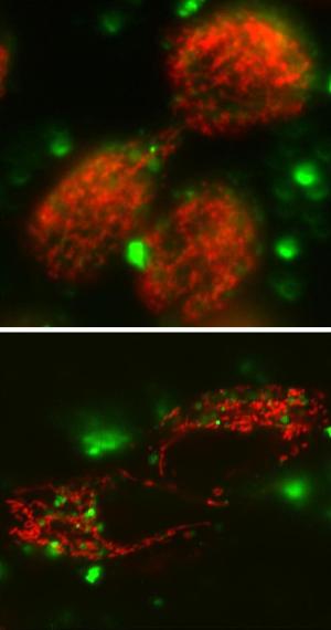 Флуоресцентные микрофотографии клеток человека, полученные с помощью традиционной (вверху) и конфокальной микроскопии (внизу). Митохондрии окрашены красным.