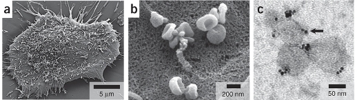 (а) Микрофотография выращенной в культуре клетки первичной человеческой глиобластомы (GBM20/3), выделяющей многочисленные микровезикулы (СЭМ). (b) Изображение с большим увеличением показывает, что многие из микровезикул на поверхности клеток имеют типичную форму блюдца, характерную для экзосом. (с) Изображение микровезикул (~ 80 нм), помеченных магнитными наночастицами (MNPs) через CD63-антитело. MNPs отображаются в виде черных точек (указано стрелкой). (ТЭМ)