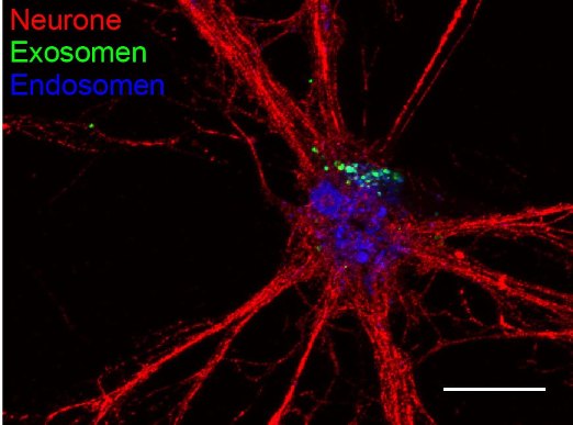 Ученым Майнцского университета Иоганна Гутенберга удалось доказать, что экзосомы поглощаются нейронами и таким образом защищают нервные клетки от стресса.