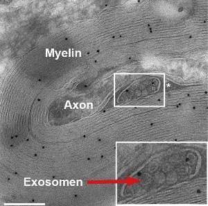 Экзосомы (красная стрелка) – мельчайшие пузырьки, содержащие белки и нуклеиновые кислоты. Они часто находятся в непосредственной близости от аксонов нейронов – идеальная позиция для передачи нейронам защитных веществ.