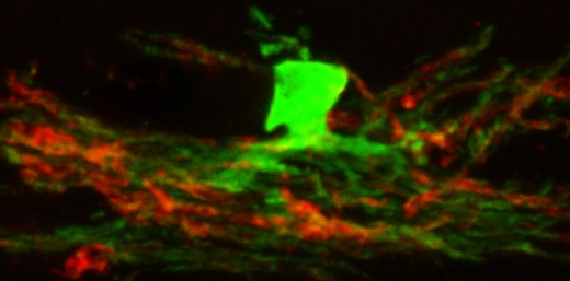 Трансплантация перепрограммированных нейральных стволовых клеток в головной мозг генетически модифицированных мышей, не способных синтезировать миелин. Стволовые клетки дифференцировались в олигодендроциты (зеленые), образующие миелин (красный).