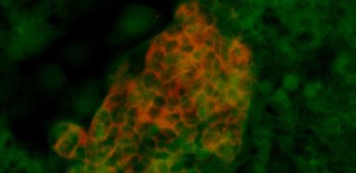 Стволовые клетки передней кишки (зеленые) дифференцировались в панкреатические клетки, экспрессирующие инсулин. Метод выращивания клеток, разработанный в Кембриджском университете, позволяет получить чистую популяцию клеток передней кишки, которые затем можно дифференцировать в клетки поджелудочной железы, пригодные для терапевтического использования.