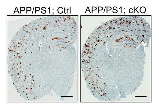 Потеря белка LRP6 в нейронах приводит к усиленному накоплению амилоидного белка – характерному признаку болезни Альцгеймера.