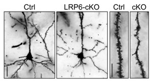 Нарушение Wnt-сигналинга в результате потери белка LRP6 приводит к дегенерации дендритных шипиков и синапсов, ухудшая тем самым коммуникацию между нейронами  головного мозга.