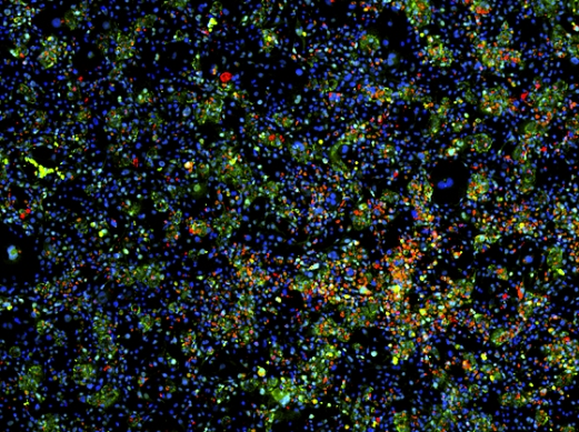 Ученые Массачусетского технологического института получили зрелые клетки печени из индуцированных плюрипотентных стволовых клеток. На снимке ядра клеток окрашены синим. Зеленым окрашены гепатоциты, красным – активно делящиеся клетки.