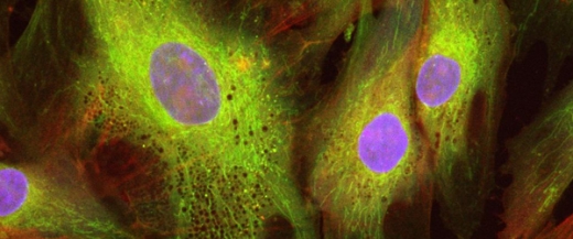 Мезенхимальные стволовые клетки