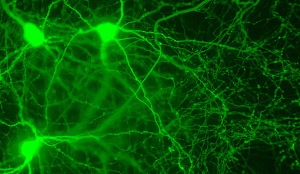 Нейроны в гиппокампе мыши