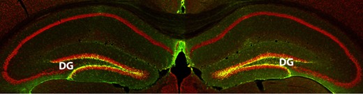 Ученые идентифицировали белок – RbAp48, – усиление экспрессии которого улучшает память у старых мышей дикого типа. На снимке желтым показан повышенный уровень RbAp48 в зубчатой извилине.