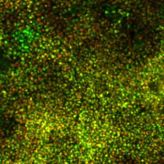 Человеческие плюрипотентные стволовые клетки дифференцировались в клетки, экспрессирующие маркеры промежуточной мезодермы. Клетки, экспрессирующие PAX2, помечены зеленым, экспрессирующие LHX1, – красным.