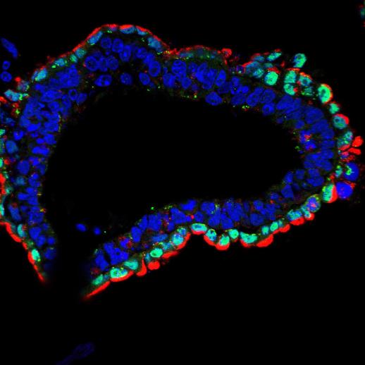 Ученые обнаружили тесную связь между лизосомами, утилизационными центрами клетки, и развитием энтодермального зародышевого листка. На снимке хорошо дифференцированная структура, полученная из нормальных эмбриональных стволовых клеток, со всеми ядрами, окрашенными в синий цвет. Только энтодермальные клетки (зеленые) содержат высокие уровни лизосом (красные).