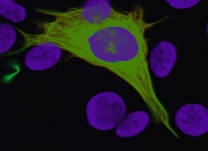 Выращенные в культуре нейроны можно окрасить и в деталях изучить под микроскопом. Ядро нейрона окрашено фиолетовым, цитоскелет – зеленым.
