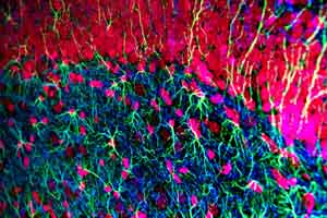 Окрашенные нейроны мыши