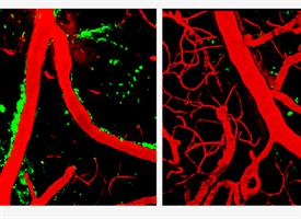 На фотографии слева показаны разрушительные белки (зеленые), выстилающие кровеносные сосуды, в живой ткани головного мозга мыши с человеческим геном ApoE4; введение препарата циклоспорин А практически удаляет опасные белки из мозговой ткани(справа).