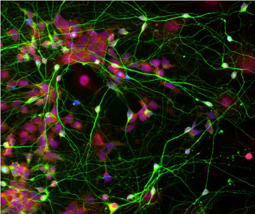 При культивировании с астроцитами человеческие нейральные стволовые клетки (показаны красным), первоначально перепрограммированные из взрослых клеток кожи, эффективно дифференцируются в зрелые нейроны (показаны зеленым).