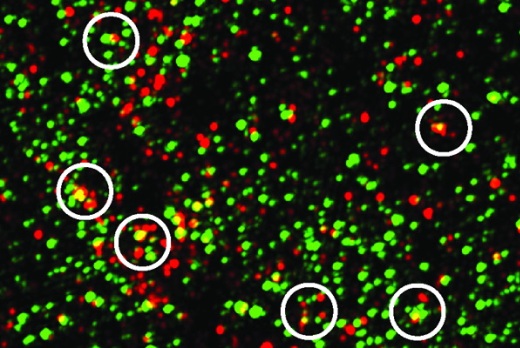 Белок-комплемент C1q (зеленый) помечает синапсы (красные) у мышей с моделью болезни Альцгеймера. Желтые точки – наложение C1q и постсинаптического белка PSD95, указывающего на синапсы. У таких мышей больше синапсов, помеченных C1q, чем у их здоровых однопометников.