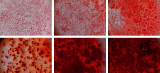 Силикатные нанопластинки индуцируют дифференцировку стволовых клеток в костные, о чем свидетельствует формирование костного матрикса (красный).
