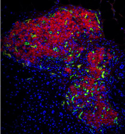 Изображение трансплантированного мыши с моделью диабета островка, доставленного в гидрогеле. (Красные области – инсулин-продуцирующие клетки, зеленые – кровеносные сосуды, синие – ДНК в ядрах клеток).