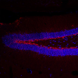 Взрослые стволовые клетки мыши (красные)