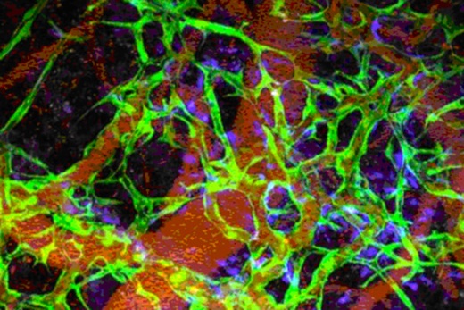 Функциональные долговечные кровеносные сосуды, выращенные в мышиной модели из человеческих индуцированных плюрипотентных стволовых клеток. Изображение, полученное методом лазерной микроскопии, показывает полученные из ИПСК эндоваскулярные клетки (зеленые), клетки соединительной ткани (синие) и эритроциты (красные).