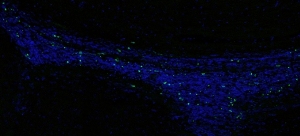 В области мозга, где отсутствуют рецепторы Mer и Axl, отчетливый «путь смерти» соответствует миграционному пути от нейрогенной области к обонятельной луковице. Синим окрашены все клетки; зеленые пятна – мертвые клетки. В той же области мозга здоровых мышей зеленых пятен нет.