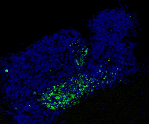 Скопление мертвых клеток (зеленые пятна) в субвентрикулярной зоне (СВЗ) – области нейрогенеза – мозга мыши, не имеющей рецепторов Mer и Axl. (Синим окрашены все клетки). В СВЗ мозга здоровой мыши зеленых пятен нет.