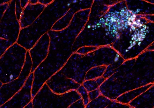 Новое исследование показывает, что стабильные микрососуды  являются нишей покоя диссеминированных раковых клеток молочной железы, в то время как вновь образующиеся микрососуды (зеленые точки) стимулируют рост этих клеток.
