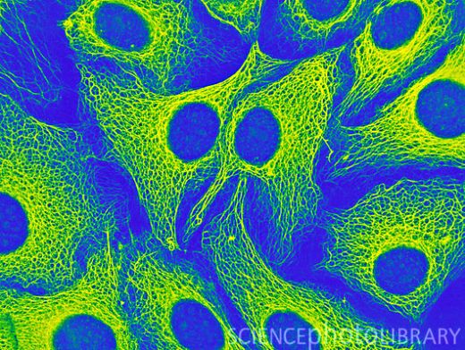 Флуоресцентная световая микрофотография цитоскелета человеческих кератиноцитов. Ядра клеток имеют овальную форму. Остальное содержимое клеток биохимически удалено. Цитоскелеты кератиноцитов видны за счет волокон кератина – основного белка волос и ногтей. Цитоскелет поддерживает форму клетку, позволяет клеткам перемещаться и участвует во внутриклеточном транспорте веществ. Кератиноциты – основной тип клеток кожи. По мере прохождения через кожу они изменяются и в конце концов превращаются в мертвые кератинизированные клетки на поверхности кожи.