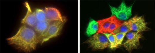 Раковые стволовые клетки могут скрываться в областях опухолей с плохим кровоснабжением и низким содержанием кислорода, где остаются стволовыми (слева). В среде с нормальным уровнем кислорода (справа) стволовые клетки образуют дифференцированные нераковые клетки (красные и зеленые).