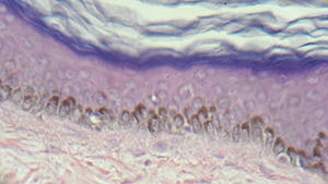 Четыре слоя человеческого эпидермиса (верхнего слоя кожи). Сверху находится роговой слой, состоящий из нескольких слоев мертвых плоских водоотталкивающих кератиноцитов. Под роговым слоем расположены зернистый, шиповатый и базальный слои. Стволовые клетки, дифференцирующиеся в кератиноциты и обновляющие кожу, находятся в базальном слое. Под базальным слоем располагается собственно кожа, или дерма, богатая белком коллагеном.