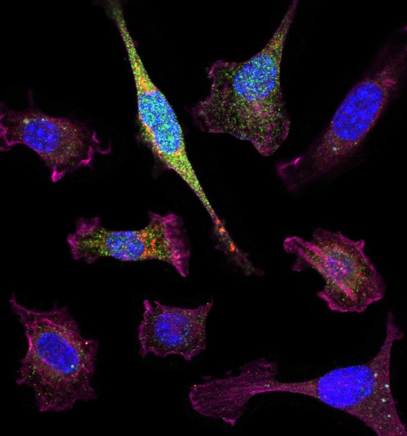Освещая хондрогенез: мышиные индуцированные плюрипотентные стволовые клетки в процессе хондрогенеза. Под контролем специфического промоутера хондроцитов в дополнение к коллагену II типа (красный) зеленый флуоресцентный белок экспрессируют F-актин (пурпурный) и ядра (синие) дифференцированных клеток. Ученые использовали сортировку клеток для получения тканеинженерного хряща для потенциального использования в лечении дефектов хряща и разработки новых препаратов для лечения остеоартрита.