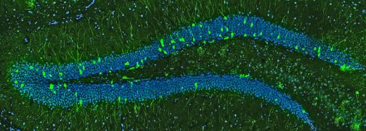 «Новорожденные» нейроны в мозге трехмесячной мыши.