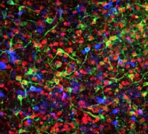 Дофамин-продуцирующие нейроны, погибающие в мозге пациентов с болезнью Паркинсона, полученные из индуцированных плюрипотентных стволовых клеток.
