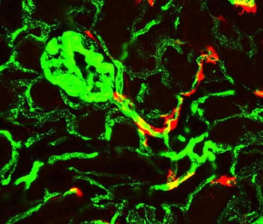 Рядом с кровеносными сосудами почки мыши (зеленые) находятся редкие стволовые клетки (красные), дифференцирующиеся в миофибробласты, секретирующие белки, способствующие образованию рубцовой ткани.