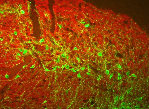 Дофаминэргические нейроны в черной субстанции крысы видны как зеленые треугольные и овальные структуры, окруженные ГАМК-содержащими отростками нейронов, окрашенными красным.