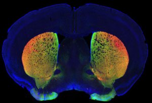 На срезе мозга мыши дофаминэргические нейроны представлены в виде красно-зеленых структур.