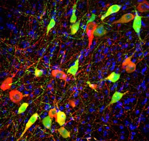 Дофаминэргические нейроны
