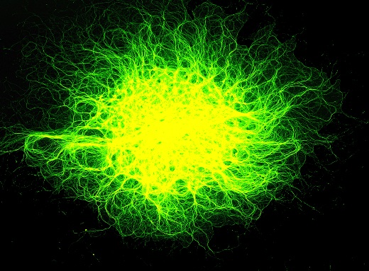 Для изучения реакции нервных клеток на повреждение их аксонов ученые Вашингтонского университета выращивают их в виде «пятен»– таких, как показано на фото, – получающихся в результате обработки поверхности клетки специфическими антителами.