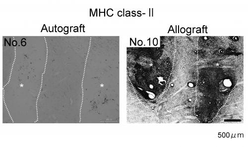 Гистологический анализ микроглии организма-реципиента. Темные части на снимке № 10 соответствуют скапливающейся микроглии.