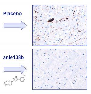 У мышей с моделью болезни Паркинсона, получавших соединение Anle138b, обнаружено значительно меньше агрегатов белка альфа-синуклеина (окрашены коричневым), чем у животных контрольной группы, получавших плацебо.