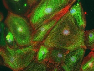 Клетки сердца, полученные из стволовых клеток с использованием CRISPR-интерференции.