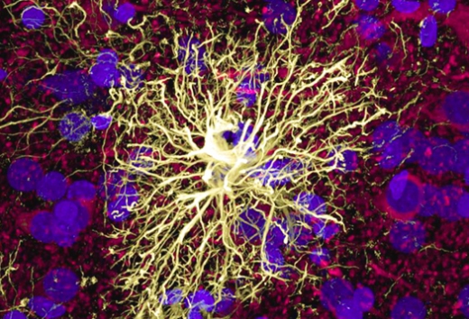 Астроцит. Ученые отводят этим клеткам ключевую роль в создании благоприятной среды для адекватной работы нейронов мозга.