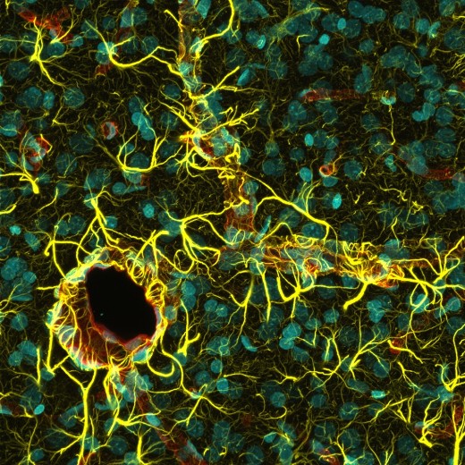 Клетки-кормилицы нейронов астроциты (желтые) и кровеносные сосуды  (красные) в коре головного мозга крысы.
