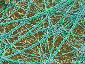Нейроны (эктодерма). Тела клеток показаны зеленым, дендриты и аксоны – синим. (Сканирующая электронная микроскопия).