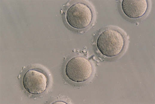 Фотография человеческой яйцеклетки. Группа ученых из MSU установила, что определенные гены, взятые из яйцеклетки, могут играть ключевую роль в получении стволовых клеток.