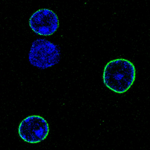 Микрофотография чрезвычайно долгоживущих белков (extremely long-lived proteins) на поверхности ядра нейронов головного мозга крысы, светящихся  зеленым светом.  ДНК внутри ядра показана синим. Ученые из Института Солка доказали, что  ELLPs, входящие в состав каналов в ядерной мембране нейронов, существуют более года. Разрушение этих белков позволяет токсинам проникать в ядро, что ведет к старению клетки.
