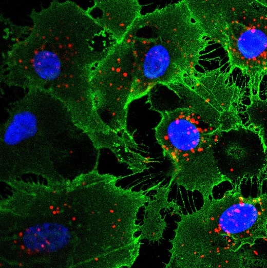 Эндотелиальные клетки, полученные путем непрямого линейного преобразования из человеческих фибробластов (клеток кожи). Ядра клеток показаны синим; белки, являющиеся отличительными признаками эндотелиальных клеток, – зеленым и красным.